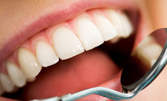 Почистване на зъбен камък и полиране на зъби, фотополимерна пломба или избелване с White Pearls