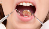 Дентален преглед и почистване на зъбен камък, плюс консултация