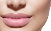 Безиглено ултразвуково влагане на хиалурон в устните