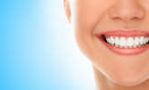 Почистване на зъбен камък с ултразвук - без или със отпечатък за нощно избелване, или пломба