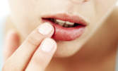 Безиглено влагане на филър със 100% хиалуронова киселина за уголемяване на устни или запълване на бръчки