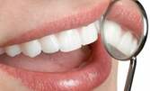Почистване на зъбен камък с ултразвук, полиране на зъби и обстоен преглед