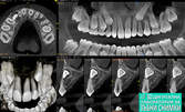 3D частичен скенер на зъбите