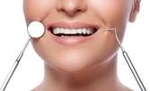 Профилактичен преглед, почистване на зъбен камък с ултразвук и полиране на зъби