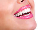 Обстоен профилактичен преглед и лечение на зъбен кариес с високоестетичен фотокомпозит