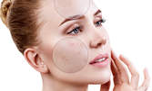 Третиране на капиляри, пигментни петна и лунички на лице с elos технология, плюс консултация с дерматолог