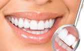 Дентален преглед, плюс почистване на зъбен камък или фотополимерна пломба, или избелване на зъби