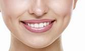 Почистване на зъбен камък, плюс преглед и план за лечение - без или със избелване на зъби