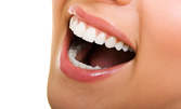 Почистване на зъбен камък, отстраняване на плака с ултразвук и полиране, плюс преглед и консултация