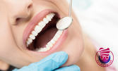 Стоматологичен преглед, плюс почистване на зъбен камък