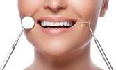 Обстоен стоматологичен преглед, почистване на зъбен камък с ултразвук и полиране