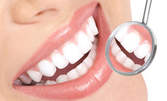 Обстоен стоматологичен преглед, почистване на зъбен камък с ултразвук и полиране на зъби