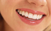 Кабинетно избелване на зъби