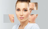 За перфектна визия: Терапия на лице - за мазна, проблемна и акнеична кожа