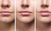 Уголемяване на устни или запълване на бръчки на лицето