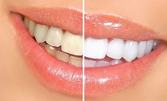 Избелване на зъби до 4 тона - бърза, безболезнена и ефективна процедура за блестяща усмивка