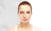 1 или 3 процедури радиочестотен лифтинг на лице, околоочен контур и двойна брадичка, с въможност за третиране и на шия