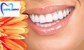 Почистване на зъбен камък с ултразвук и полиране или фотополимерна пломба - с до 65% отстъпка