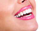 Избелване на зъби със 100% натурален гел Magic White