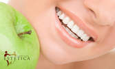 Почистване на зъбен камък с ултразвук и полиране, плюс обстоен преглед и план за лечение
