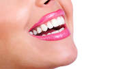 Почистване на зъбен камък или фотополимеризираща пломба, плюс полиране, преглед и консултация