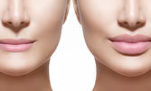 Серия от 6 терапии с хиалуронова киселина - за по-плътни и пухкави устни, плюс консултация от козметик-дерматолог