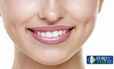 Избелване на зъби - с избелващ агент в домашни условия или лазарно избелване в кабинет