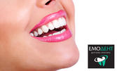 За безупречна усмивка! Професионално почистване на зъбен камък с ултразвук и АirFlow, плюс преглед, консултация и план за лечение