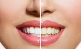 Почистване на зъбен камък, премахване на оцветявания по зъбите, полиране и преглед