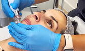 Медицинско почистване на лице или кислородна мезотерапия