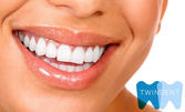 За искрящо бяла усмивка! Преглед, почистване на зъбен камък, полиране с Airflow и избелване на зъби