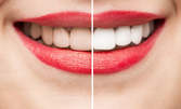 Кабинетно избелване на зъби, плюс почистване на зъбен камък