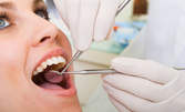 Преглед, почистване на зъбен камък и полиране, или лечение на кариес с фотополимерна пломба