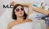 Гладка кожа с дълготраен ефект - лазерна епилация за жени