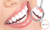 За зъбите: Изработка и поставяне на металокерамична корона, плюс обстоен преглед и изготвяне на план за лечение