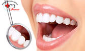 Пълен дентален преглед, почистване на зъбен камък и полиране, или фотополимерна пломба