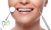 Почистване на зъбен камък с ултразвук и полиране, плюс преглед и план за лечение