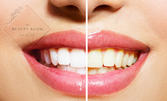 Избелване на зъби с LED лампа, реминерализация или зъбни бижута, плюс обстоен преглед