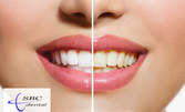 До 8 нюанса по-бели зъби! Избелване с LED лампа, почистване на зъбен камък и полиране
