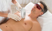 Пакет от 6 процедури лазерна епилация за мъже на цяло тяло или зона по избор