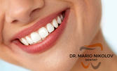 Професионално почистване на зъбен камък с ултразвук, полиране и обстоен стоматологичен преглед