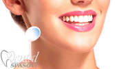 Преглед, почистване на зъбен камък с ултразвук и полиране на зъбите