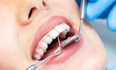 Почистване на зъбен камък с ултразвук и полиране с AirFlow, плюс преглед и консултация