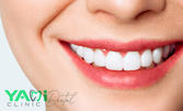 За красива усмивка! Почистване на зъбен камък с ултразвук и полиране с Аirflow, плюс преглед и план за лечение