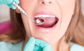 Почистване на зъбен камък, зъбна плака с ултразвук, плюс полиране и премахване на оцветяване с Airflow