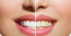SuN - Dental