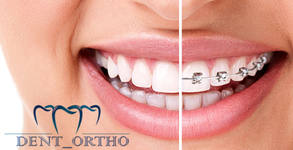 Dent-ortho - Д-р Попов