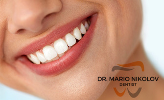 Професионално почистване на зъбен камък с ултразвук, полиране и обстоен стоматологичен преглед, от Д-р Марио Николов
