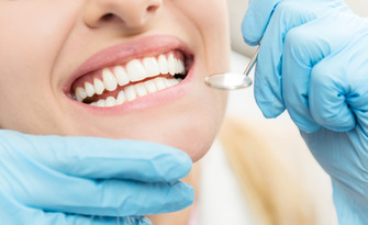Почистване на зъбен камък и полиране с Airflow, плюс обстоен преглед и план на лечение, от Afrodita Aesthetic and Dental Care