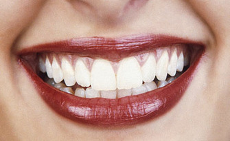 Почистване на зъбен камък с ултразвук и полиране с паста, плюс профилактичен преглед, от Д-р Анна Генчева